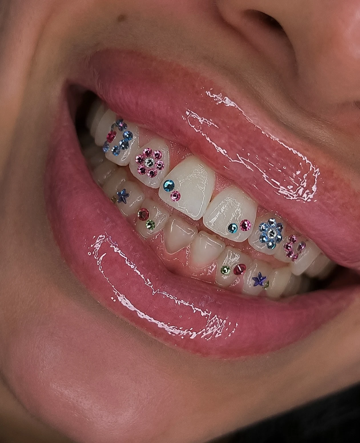 Tooth Gems